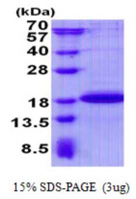 SDS-Page: Recombinant Human PGL2 Protein [NBP2-22834]