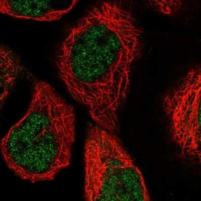 <b>Independent Antibodies Validation. </b>Immunocytochemistry/Immunofluorescence: PGLS Antibody [NBP2-47333] - Immunofluorescent staining of human cell line A-431 shows localization to nucleoplasm.