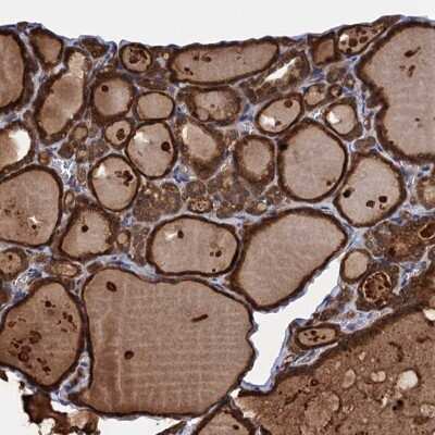 Immunohistochemistry: PGLS Antibody [NBP2-47333] - Staining of human thyroid gland shows strong cytoplasmic positivity in glandular cells.