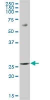 Western Blot: PGLS Antibody [H00025796-B01P] - Analysis of PGLS expression in human spleen.