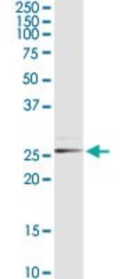 Western Blot: PGLS Antibody [H00025796-D01P] - Analysis of PGLS expression in Hela S3 NE.