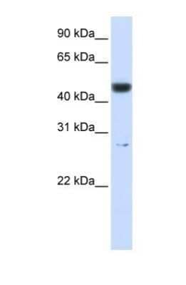 Western Blot: PGLS Antibody [NBP1-56387] - 721_B tissue lysate at a concentration of 1ug/ml.