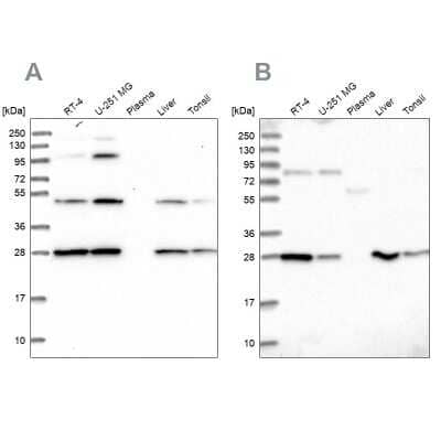 Western Blot: PGLS Antibody [NBP2-47333] - Analysis using Anti-PGLS antibody NBP2-47333 (A) shows similar pattern to independent antibody NBP2-47334 (B).