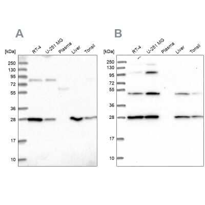 Western Blot: PGLS Antibody [NBP2-47334] - Analysis using Anti-PGLS antibody NBP2-47334 (A) shows similar pattern to independent antibody NBP2-47333 (B).