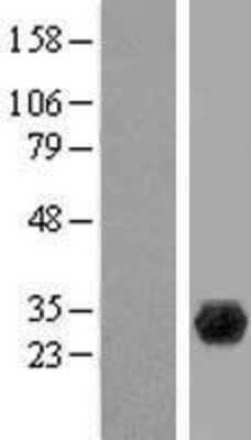 Western Blot PGLS Overexpression Lysate