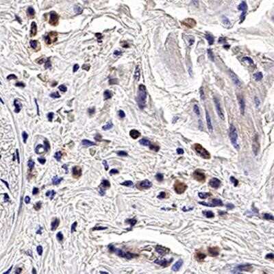 Immunohistochemistry: PGLYRP1/PGRP-S Antibody (188C424) - Azide and BSA Free [NBP2-80909] - IHC analysis of formalin fixed paraffin-embedded (FFPE) human esophagus using PGLYRPI/PGRP-S antibody at 20 ug/ml on a Bond Rx autostainer (Leica Biosystems). The assay involved 20 minutes of heat induced antigen retrieval (HIER) using 10mM sodium citrate