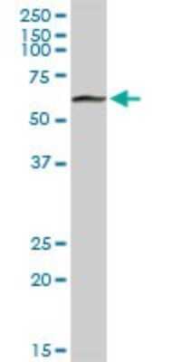 Western Blot: PGM1 Antibody [H00005236-D01P] - Analysis of PGM1 expression in human liver.