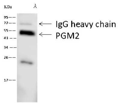 Immunoprecipitation: PGM2 Antibody [NBP2-99596] - PGM2 was immunoprecipitated using: Lane A: 0.5 mg Hela Whole Cell Lysate. 1 ul anti-PGM2 rabbit polyclonal antibody and 60 ug of Immunomagnetic beads. Protein A/G. Primary antibody: Anti-PGM2 rabbit polyclonal antibody, at 1:500 dilution. Secondary antibody: Goat Anti-Rabbit IgG (H+L)/HRP at 1/10000 dilution. Developed using the ECL technique. Performed under reducing conditions. Predicted band size: 15 kDa. Observed band size: 15 kDa