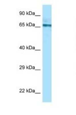 Western Blot: PGM2 Antibody [NBP1-98407] - Titration: 1.0 ug/ml Positive Control: THP-1 Whole Cell.