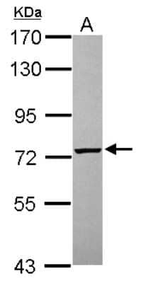 Western Blot: PGM2 Antibody [NBP2-19786] - Sample (30 ug of whole cell lysate) A: A431 7. 5% SDS PAGE gel, diluted at 1:1000.