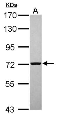 Western Blot: PGM2 Antibody [NBP2-19787] - Sample (30 ug of whole cell lysate) A: A431 7. 5% SDS PAGE gel, diluted at 1:1000.