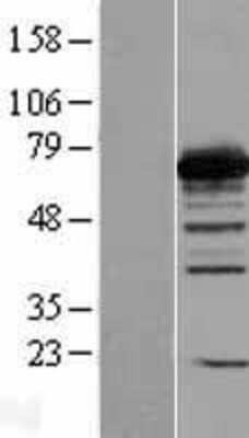 Western Blot: PGM2 Overexpression Lysate (Adult Normal) [NBL1-14338] Left-Empty vector transfected control cell lysate (HEK293 cell lysate); Right -Over-expression Lysate for PGM2.