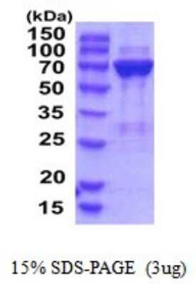 SDS-Page: PGM2 Recombinant Protein [NBP2-52138] - 15% SDS Page (3 ug)