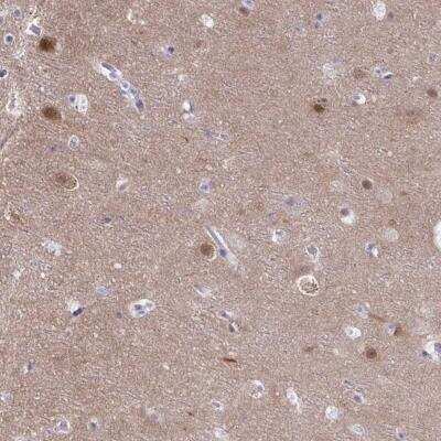 Immunohistochemistry-Paraffin PGM2L1 Antibody - BSA Free