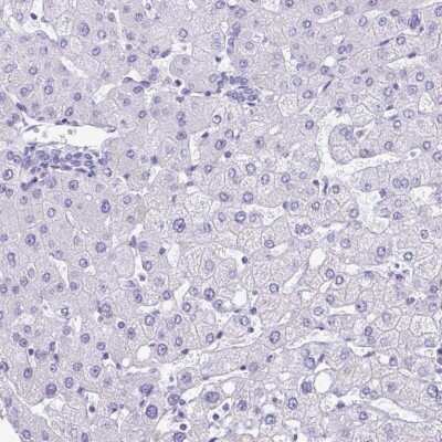 Immunohistochemistry-Paraffin PGM2L1 Antibody - BSA Free