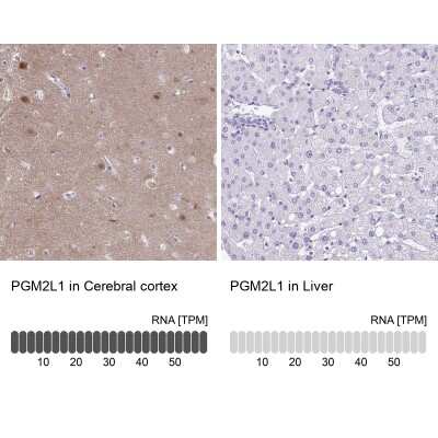 Immunohistochemistry-Paraffin PGM2L1 Antibody - BSA Free