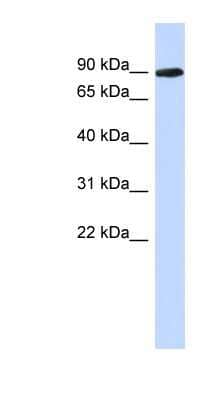 Western Blot: PGM2L1 Antibody [NBP1-56592] - Human Placenta lysate, concentration 0.2-1 ug/ml.