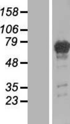 Western Blot: PGM2L1 Overexpression Lysate (Adult Normal) [NBL1-14339] Left-Empty vector transfected control cell lysate (HEK293 cell lysate); Right -Over-expression Lysate for PGM2L1.