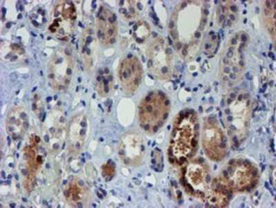 Immunohistochemistry: PGM3 Antibody (OTI1A11) - Azide and BSA Free [NBP2-73362] - Staining of paraffin-embedded Human Kidney tissue using anti-PGM3 mouse monoclonal antibody.