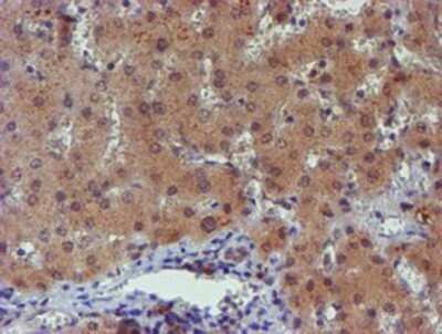 Immunohistochemistry: PGM3 Antibody (OTI1A11) - Azide and BSA Free [NBP2-73362] - Staining of paraffin-embedded Human liver tissue using anti-PGM3 mouse monoclonal antibody.