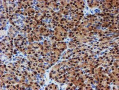 Immunohistochemistry: PGM3 Antibody (OTI1A11) - Azide and BSA Free [NBP2-73362] - Staining of paraffin-embedded Human pancreas tissue using anti-PGM3 mouse monoclonal antibody.