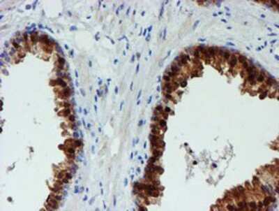 Immunohistochemistry: PGM3 Antibody (OTI1A11) - Azide and BSA Free [NBP2-73362] - Staining of paraffin-embedded Human prostate tissue using anti-PGM3 mouse monoclonal antibody.