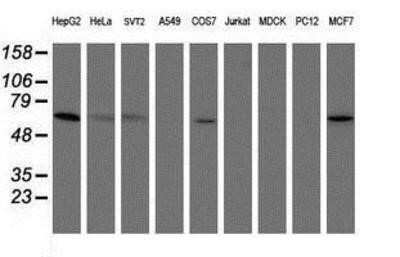 Western Blot: PGM3 Antibody (OTI1A11) - Azide and BSA Free [NBP2-73362] - Analysis of extracts (35ug) from 9 different cell lines by using g anti-PGM3 monoclonal antibody (HepG2: human; HeLa: human; SVT2: mouse; A549: human; COS7: monkey; Jurkat: human; MDCK: canine; PC12: rat; MCF7: human).