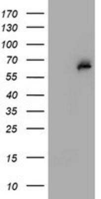 Western Blot: PGM3 Antibody (OTI1A11) - Azide and BSA Free [NBP2-73362] - HEK293T cells were transfected with the pCMV6-ENTRY control (Left lane) or pCMV6-ENTRY PGM3 (Right lane) cDNA for 48 hrs and lysed. Equivalent amounts of cell lysates (5 ug per lane) were separated by SDS-PAGE and immunoblotted with anti-PGM3.
