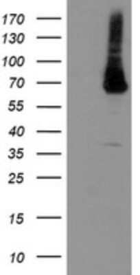 Western Blot: PGM3 Antibody (OTI5C6) - Azide and BSA Free [NBP2-73364] - Analysis of HEK293T cells were transfected with the pCMV6-ENTRY control (Left lane) or pCMV6-ENTRY PGM3.