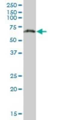 Western Blot: PGM3 Antibody [H00005238-B01P] - Analysis of PGM3 expression in human liver.