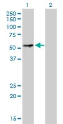 Western Blot: PGM3 Antibody [H00005238-D01P] - Analysis of PGM3 expression in transfected 293T cell line by PGM3 polyclonal antibody.Lane 1: PGM3 transfected lysate(59.90 KDa).Lane 2: Non-transfected lysate.