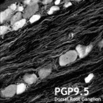 Immunohistochemistry: PGP9.5 / UCHL-1 Antibody (10A1) [NB100-1926] -  PGP9.5 immunoreactivity in the cytoplasm of neuronal cell bodies in tracheal ganglion.