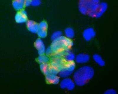 Immunocytochemistry/Immunofluorescence: PGP9.5 / UCHL-1 Antibody (BH7) [NB110-58869] - Shows human embryonic kidney cell line 293 stained with mouse monoclonal to UCHL1 (NB110-58869) (green) and  rabbit antibody to neurofilament NF-M, (NB300-133), (red). Blue is a DNA stain. Note that some of the Hek293 cells, which perhaps surprisingly have some properties of neuronal lineage cells (4), are beginning to express both UCHL1 and NF-M, both markers of neurons. The majority of cells, however express neither protein. Note that the UCHL1 is cytoplasmic and diffuse while the NF-M is concentrated in cytoplasmic filaments.