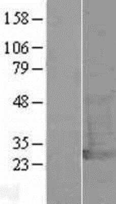 Western Blot: PGP9.5 / UCHL-1 Overexpression Lysate (Native) [NBL1-17575] - Left-Empty vector transfected control cell lysate (HEK293 cell lysate); Right -Over-expression Lysate for UCHL1.