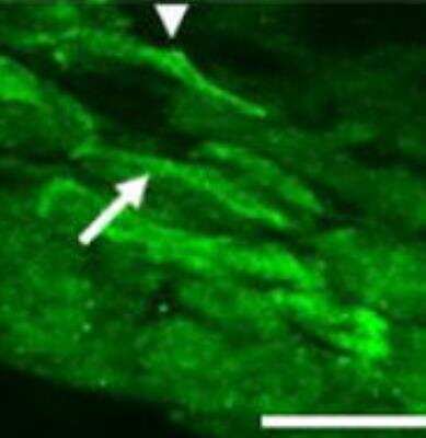 Immunohistochemistry: UCH-L1/PGP9.5 Antibody [NB100-1640] - PGP9.5 / UCHL-1 Antibody [NB100-1640] - Staining of the synovium from ASIC3 +/+ mice with joint inflammation.  Bar = 25 um. doi: 0.1016/j.pain.2008.01.020.