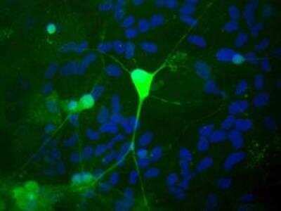 Immunocytochemistry/Immunofluorescence: PGP9.5 / UCHL-1 Antibody [NB110-58874] - Shows rat mixed neuron/glial cultures stained with Rabbit anti-UCHL1 antibody (green). Blue is a DNA stain. Note that the UCHL1 stains neurons strongly and specifically, and that the staining is concentrated in the cell bodies, though some does extend into the dendrites also.