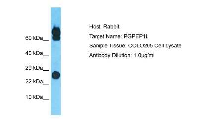 Western Blot: PGPEP1L Antibody [NBP2-83385] - Host: Rabbit. Target Name: PGPEP1L. Sample Type: COLO205 Whole Cell lysates. Antibody Dilution: 1.0ug/ml