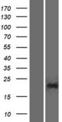Western Blot: PGPEP1L Overexpression Lysate (Adult Normal) [NBP2-08243] Left-Empty vector transfected control cell lysate (HEK293 cell lysate); Right -Over-expression Lysate for PGPEP1L.