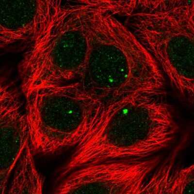 Immunocytochemistry/Immunofluorescence: PGPase Antibody [NBP2-30549] - Immunofluorescent staining of human cell line MCF7 shows localization to nuclear bodies.