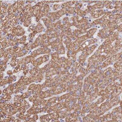 Immunohistochemistry: PGPase Antibody [NBP2-30549] - Staining of human liver shows strong cytoplasmic positivity in hepatocytes.