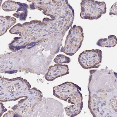 Immunohistochemistry-Paraffin: PGPase Antibody [NBP2-30549] - Staining of human placenta shows moderate granular cytoplasmic positivity in trophoblastic cells.