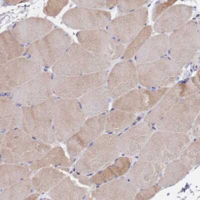 Immunohistochemistry-Paraffin: PGPase Antibody [NBP2-30549] - Staining of human skeletal muscle shows weak to moderate cytoplasmic positivity in myocytes.