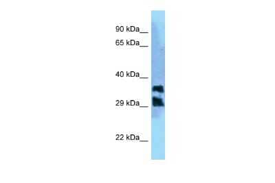 Western Blot: PGPase Antibody [NBP2-85469] - WB Suggested Anti-PGP Antibody. Titration: 1.0 ug/ml. Positive Control: HepG2 Whole Cell