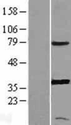 Western Blot: PGR1 Overexpression Lysate (Adult Normal) [NBL1-14941] Left-Empty vector transfected control cell lysate (HEK293 cell lysate); Right -Over-expression Lysate for PGR1.