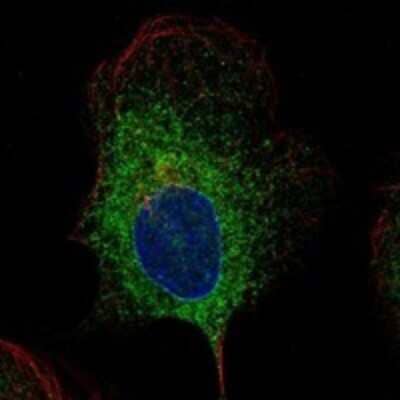 Immunocytochemistry/Immunofluorescence: PGRMC1 Antibody [NBP3-17641] - Staining of human cell line U-2 OS shows localization to endoplasmic reticulum.