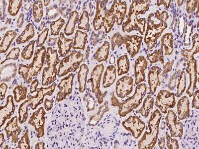 Immunohistochemistry-Paraffin: PGRMC1 Antibody [NBP2-97696] - Immunochemical staining of human PGRMC1 in human liver with rabbit polyclonal antibody at 1:100 dilution, formalin-fixed paraffin embedded sections.