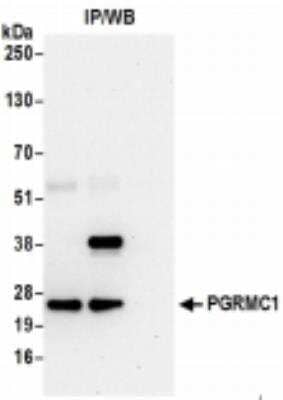 Immunoprecipitation: PGRMC1 Antibody [NBP2-36525] - Samples: Whole cell lysate (0.5 or 1.0 mg per IP reaction; 20% of IP loaded) from 293T cells prepared using RIPA lysis buffer. For blotting immunoprecipitated PGRMC1,it was used at 1 ug/ml. Detection: Chemiluminescence with an exposure time of 30 seconds.