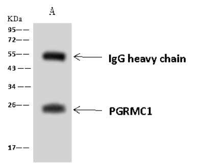 Immunoprecipitation: PGRMC1 Antibody [NBP2-97696] - PGRMC1 was immunoprecipitated using: Lane A: 0.5 mg MCF7 Whole Cell Lysate 4 ul anti-PGRMC1 rabbit polyclonal antibody and 60 ug of Immunomagnetic beads Protein A/G.  Primary antibody: Anti-PGRMC1 rabbit polyclonal antibody, at 1:100 dilution. Secondary antibody: Goat Anti-Rabbit IgG (H+L)/HRP at 1/10000 dilution. Developed using the ECL technique. Performed under reducing conditions. Predicted band size: 22 kDa. Observed band size: 25 kDa