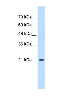 Western Blot: PGRMC1 Antibody [NBP1-59827] - HepG2 cell lysate, Antibody Titration: 0.2-1 ug/ml