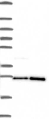 Western Blot: PGRMC1 Antibody [NBP3-17641] - Lane 1: Marker [kDa] 250, 130, 95, 72, 55, 36, 28, 17, 10;   Lane 2: RT4;   Lane 3: U-251 MG